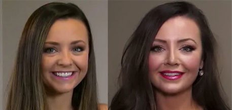 Utopia Houston Nasal Institute