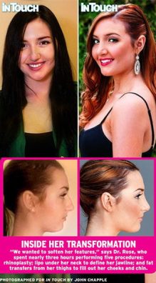 Utopia Houston Nasal Institute